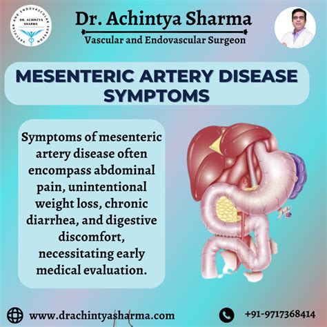 notablog|mesenteric artery syndrome blog.